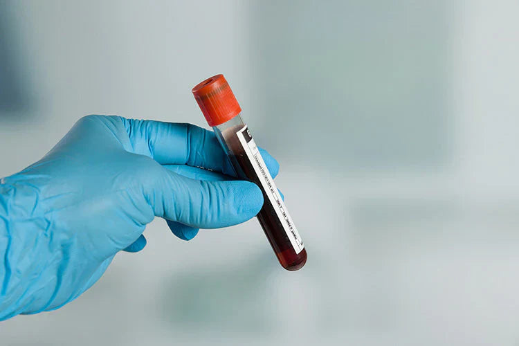 Microplastics found in human blood for the 1st time, study says